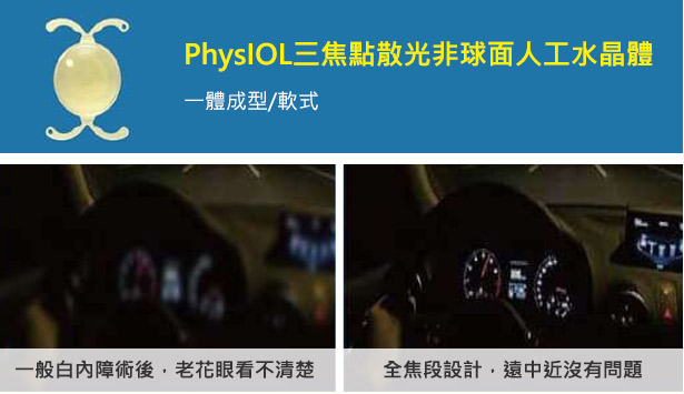 PhysIOL三焦點散光非球面人工水晶體(一體成形/軟式)