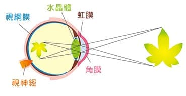 近視 Myopia